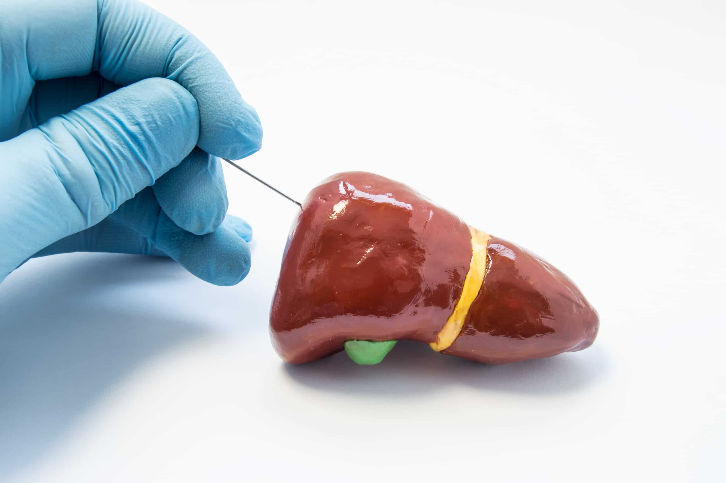 liver-biopsy-turkiye